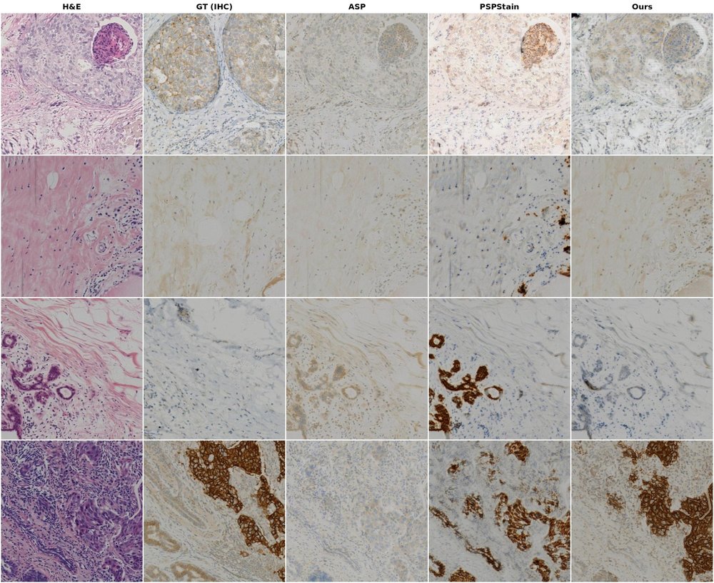 Visual comparison with baselines on BCI