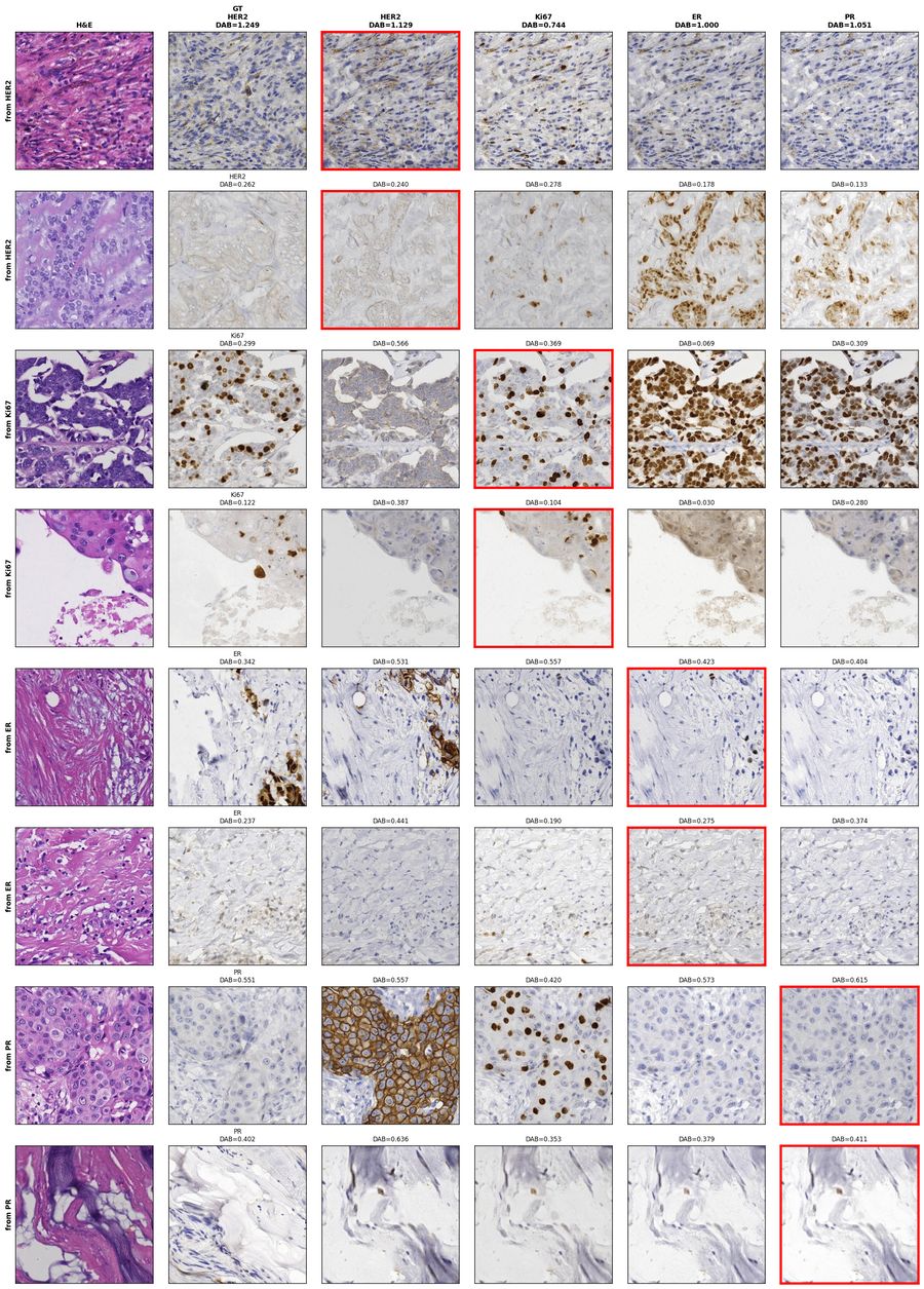 Cross-stain generation: one H&E input produces HER2, Ki67, ER, and PR