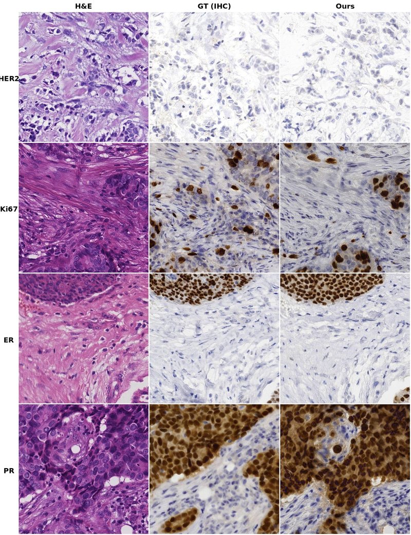 Ground truth vs generated IHC for all four stains